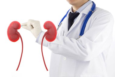 doktor kontrol 3d böbrek ürolojisi , tıp ile böbrek hastalığı
