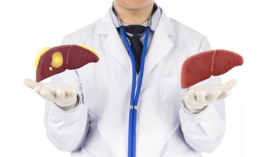 Doktor yağlı karaciğere dokunuyor, yağlı karaciğer kavramı