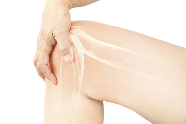 Kniebenen Pijn Witte Achtergrond Knieblessure — Stockfoto