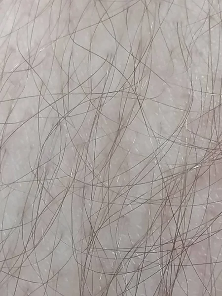 Bir Yetişkinin Açık Teninde Siyah Saçlar Çıkıyor — Stok fotoğraf