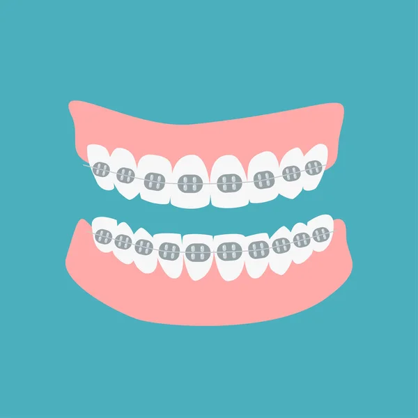 Zahnfleischsymbole Mit Zähnen Und Zahnspangen Isoliert Auf Grünem Hintergrund Ausrichtungszähne — Stockvektor