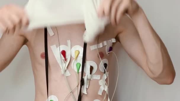 Mladý Hubený Muž Bílém Pozadí Obléká Košili Holter Monitor Připojen — Stock video