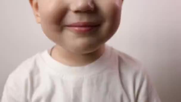 Close Tiro Três Anos Bebê Menino Sorriso Com Dentes Pretos — Vídeo de Stock