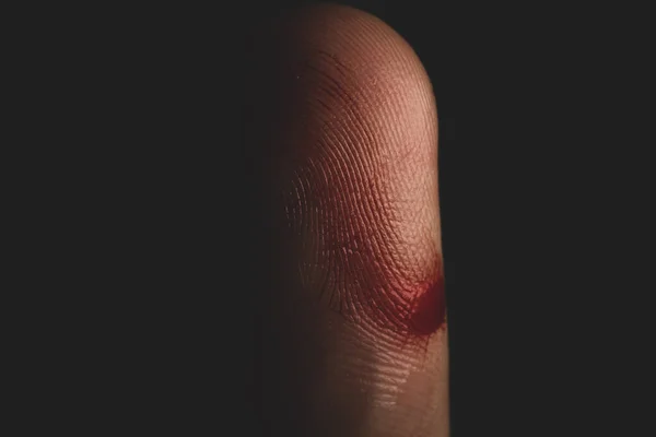 Macro close up portrait of a finger cut injury , studio lighting, selective focus