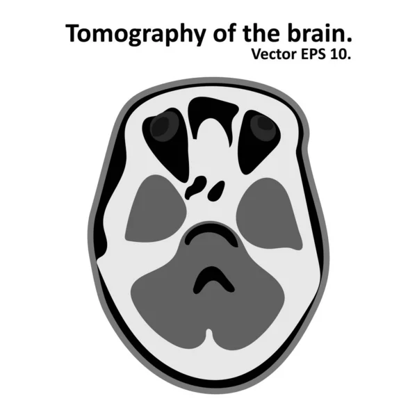 Sección Transversal Del Cerebro Con Resonancia Magnética Resonancia Magnética Vector — Archivo Imágenes Vectoriales