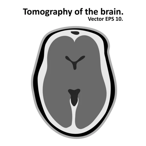 Magnetic Resonance Imaging Brain Cross Section Brain Mri Scan Vector — Stock Vector