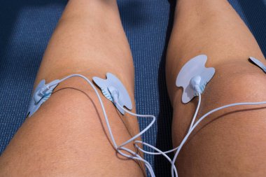 Elektrostimülasyon vücuttaki hareket kabiliyetini artırmaya ve ayrıca kasları sıkılaştırmaya yarar.