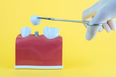 Diş fırçası ile sarı arka plan üzerinde yanlış ağız