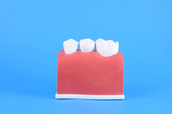 Dentista de boca falsa em fundo azul — Fotografia de Stock