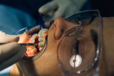 bir diş hekimi kız ile bir diş kliniğinde beyaz bir kız beyaz diş parantez yerleştirme süreci