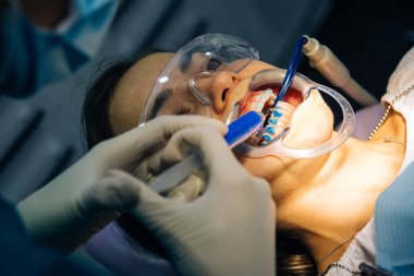 bir diş hekimi kız ile bir diş kliniğinde beyaz bir kız beyaz diş parantez yerleştirme süreci