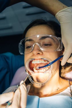 bir diş hekimi kız ile bir diş kliniğinde beyaz bir kız beyaz diş parantez yerleştirme süreci