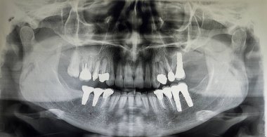 Erişkin bir hastanın ortopedisi