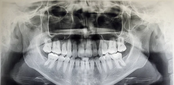 Ortografía de un paciente adulto, odontología — Foto de Stock
