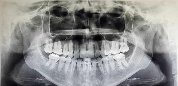 Ortografía de un paciente adulto, odontología —  Fotos de Stock