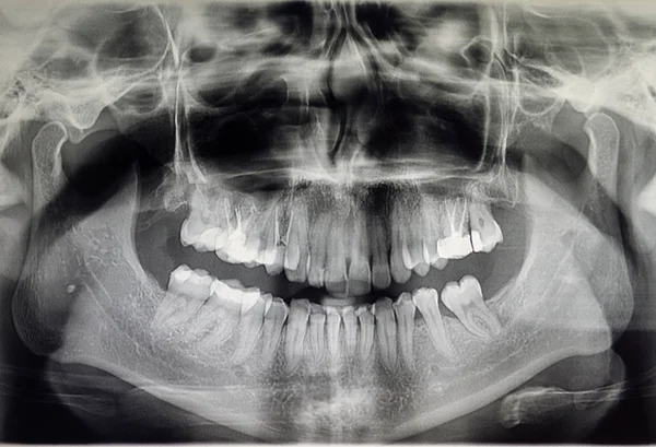 Ortografía de un paciente adulto, odontología — Foto de Stock