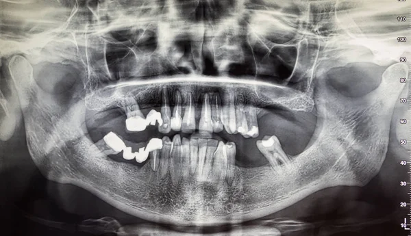 Ortografía de un paciente adulto, odontología —  Fotos de Stock