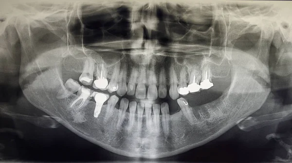 Ortografía de un paciente adulto, odontología —  Fotos de Stock