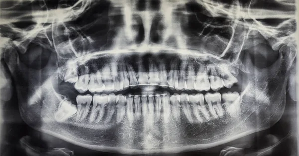 Ortografía de un paciente adulto, odontología —  Fotos de Stock