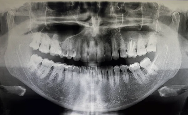 Ortografía de un paciente adulto, odontología —  Fotos de Stock