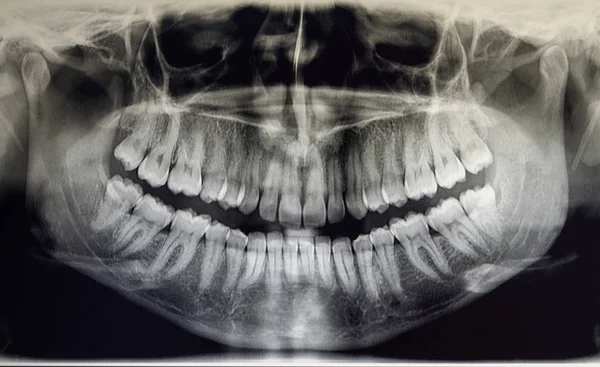 Ортопантомография взрослого пациента, стоматология — стоковое фото