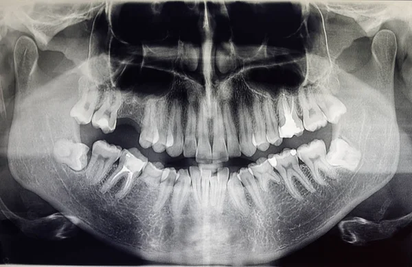 Ortografía de un paciente adulto, odontología — Foto de Stock