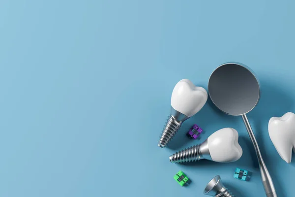 Implanty zębów śrubowych i lustro, niebieskie tło — Zdjęcie stockowe