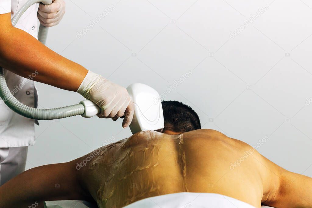 laser depilation of the male back, concept of male care and depilation of the man