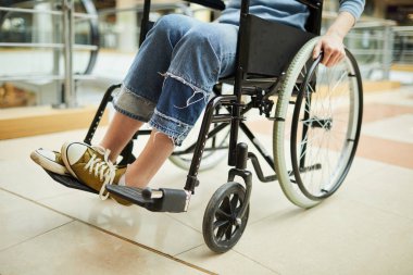 Hastanedeki tekerlekli sandalyede oturan engelli kadın hastaya yakın çekim