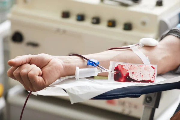 Close Mulher Com Cateter Braço Doando Sangue Hospital — Fotografia de Stock