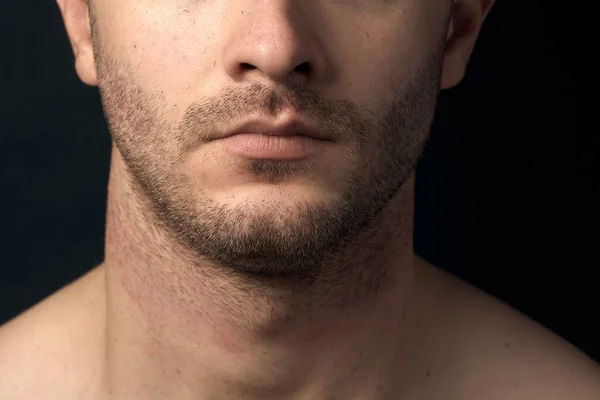 Cerda Barbilla Masculina Cerca Desordenado Sin Afeitar —  Fotos de Stock