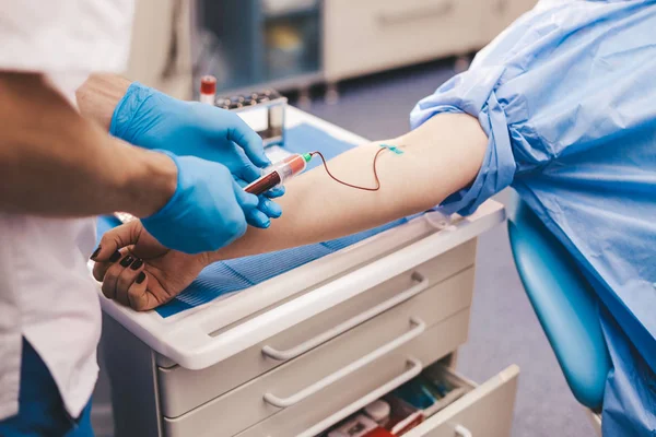 Detalles de cerca de una recolección de sangre de un donante joven, en una clínica moderna, recogiendo la sangre de la mano — Foto de Stock