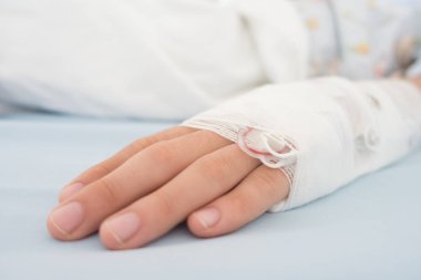 Küçük çocuk olsun hasta grip tuzlu Intravenous (IV) satır içi el basıncı ile hastaneye yatırılması gerek