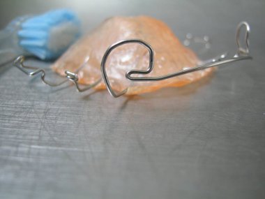 Ağız hijyeni için temizlenecek ortodontik aletin çıkarılması. Tedavinin sözel özelliklerinden oluşan özel plastik ve paslanmaz çelik telden yapılmış ortodontik Alet.    
