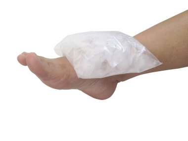 Beyaz arka planda buz ile sıkıştırma ayak bileği. Beyaz arka plan üzerinde buz paketi izole edin. Beyaz üzerinde soğuk kompres.