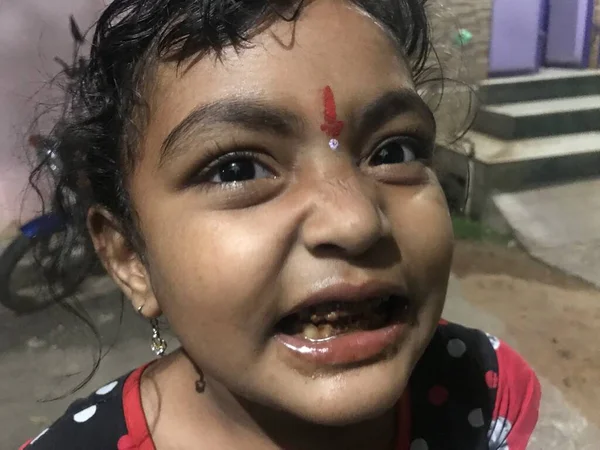 Çikolata yiyen küçük bir kız ya da kız. Bu da diş çürümesine neden olur.