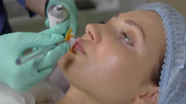 Anestesia a superfície dos lábios antes da injeção de ácido hialurônico — Vídeo de Stock