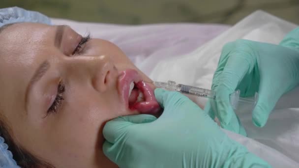 Esteticista faz o procedimento de aumento labial com uma injeção de hialurão — Vídeo de Stock
