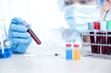 Doktorun elinde analiz ve test virüsü hastalığı için örnek bir kan tüpü var, bu araştırma, teşhis için plazma biyotıbbı..