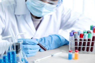 Doktorun elinde analiz ve test virüsü hastalığı için örnek bir kan tüpü var, bu araştırma, teşhis için plazma biyotıbbı..