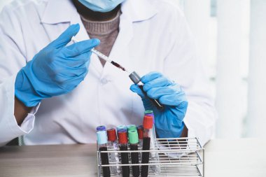 Doktorun elinde analiz ve test virüsü hastalığı için örnek bir kan tüpü var, bu araştırma, teşhis için plazma biyotıbbı..