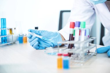 Doktor, pipeti tutar ve mavi kimyasal sıvıyı laboratuarda virüs ve bakteri hastalıklarını tedavi etmek için araştırma ve analiz için bir petri kabına atar..