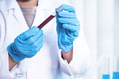 Doktorun elinde analiz ve test virüsü hastalığı için örnek bir kan tüpü var, bu araştırma, teşhis için plazma biyotıbbı..