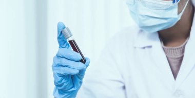 Doktorun elinde analiz ve test virüsü hastalığı için örnek bir kan tüpü var, bu araştırma, teşhis için plazma biyotıbbı..