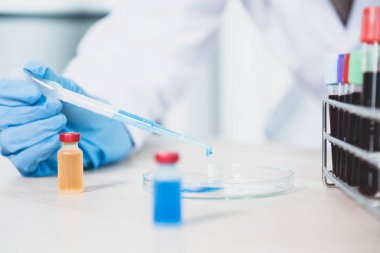 Doktor pipeti tut ve mavi kimyasal sıvıyı laboratuarda virüs ve bakteri hastalıklarını tedavi etmek için araştırma ve analiz için bir petri kabına koy..