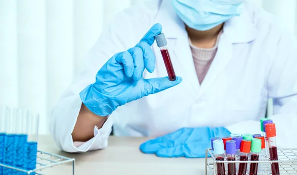 Doctor Hand Holding Sample Blood Tube Analysis Test Virus Disease — Stock Photo, Image