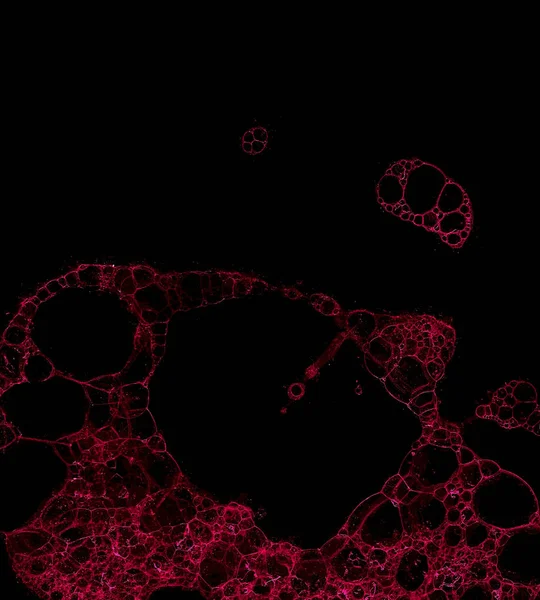 要旨グランジ細胞の背景 — ストック写真
