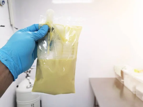 Mano Sosteniendo Una Bolsa Nutrientes Departamento Nutrición Hospital Alimentos Líquidos — Foto de Stock