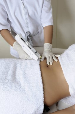 Kozmetoloji. Güzel Kadın Vücudu Üzerine Lazer Epilasyon Tedavisi Yapan Güzellik Yakınçekim, İpeksi Cilt Üzerinde Saç Çıkarma. Güzellik Salonunda Hafif Epilasyon Prosedürü Alan Kadın.