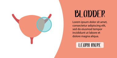 İnsan mesanesi teşhisi. Ystitis, mesane taşı, kanser. Vektör düz çizim. Pankart, iniş sayfası ve web sitesi için mükemmel